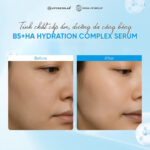 Tinh chất AVO B5+HA