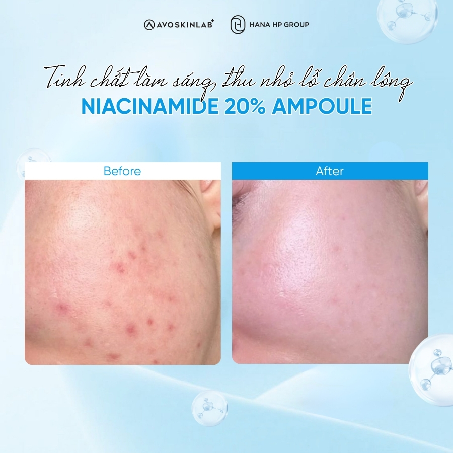 AVO Niacinamide 20% Ampoule