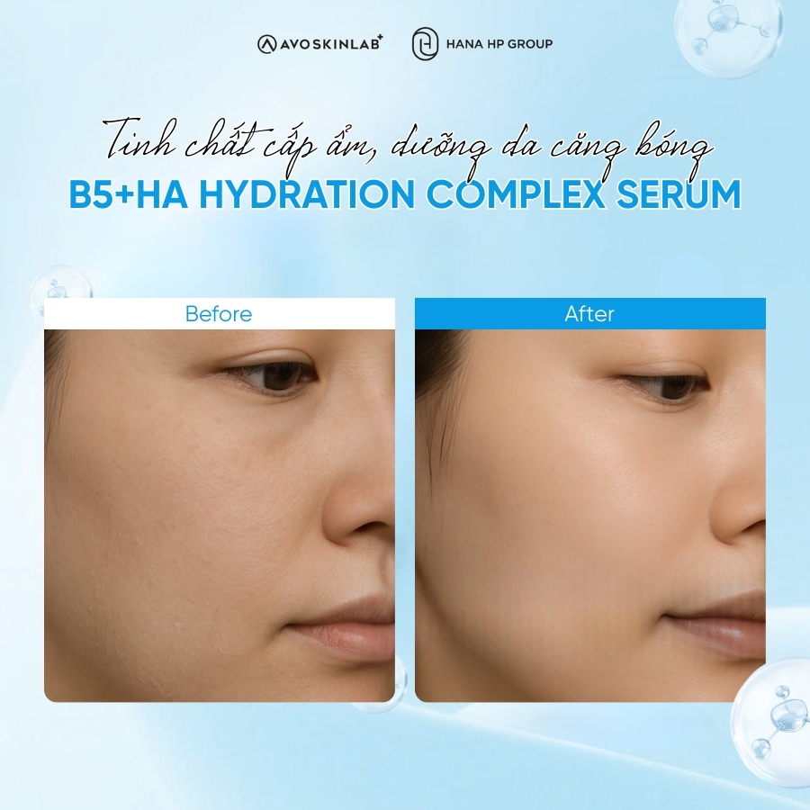 Tinh chất AVO B5+HA