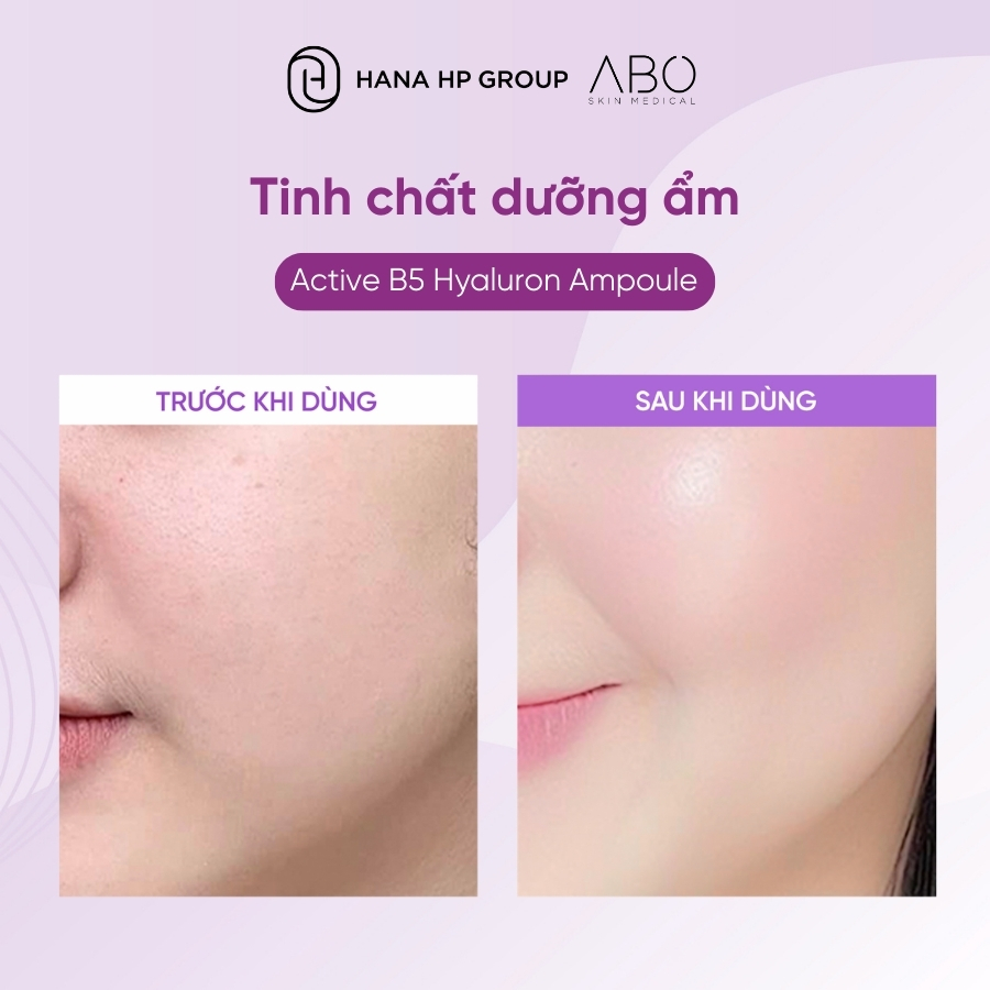 Tinh chất ABO