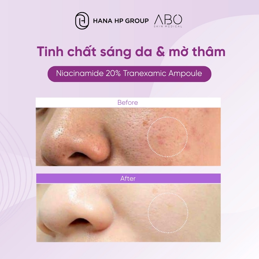 tinh chất dưỡng sáng ABO