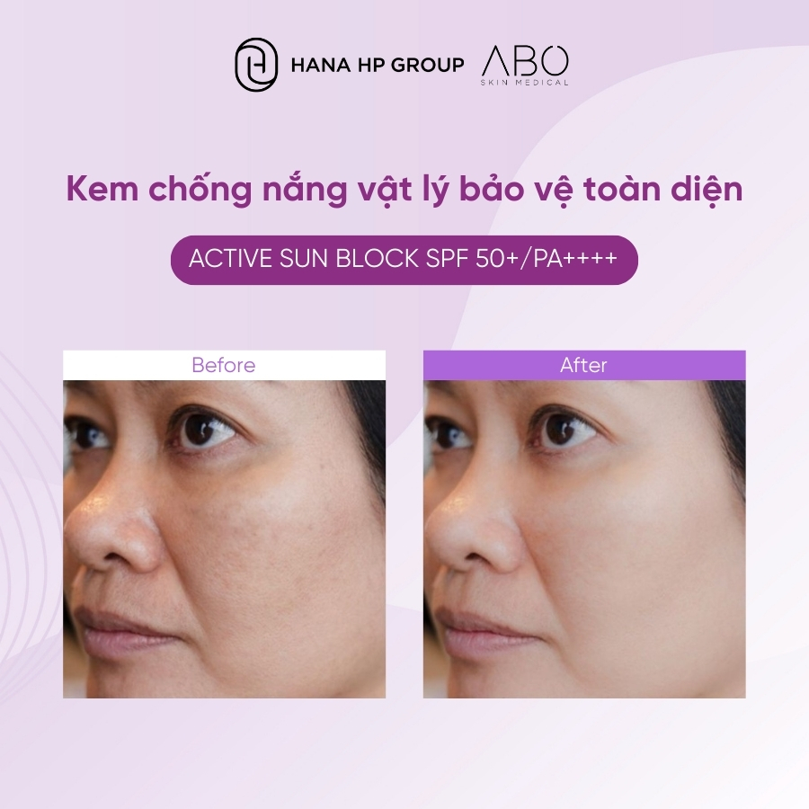 Kem chống nắng ABO