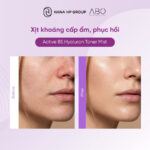 toner mist abo