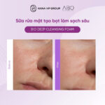 sữa rửa mặt ABO