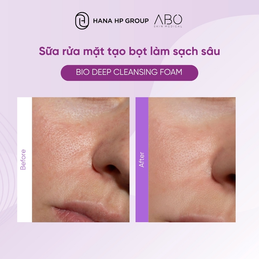 sữa rửa mặt ABO