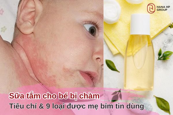 sữa tắm cho bé bị chàm