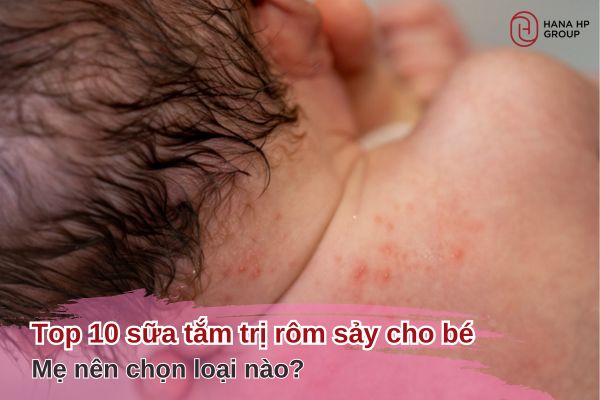 sữa tắm trị rôm sảy cho bé