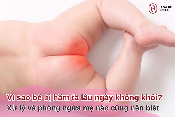bé bị hăm tã lâu ngày không khỏi