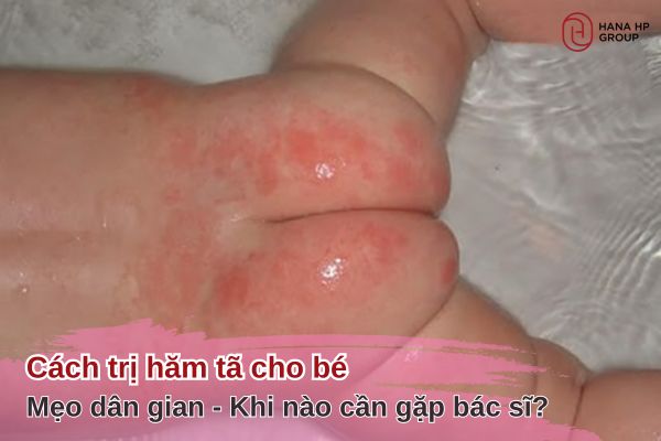 cách trị hăm tã cho bé