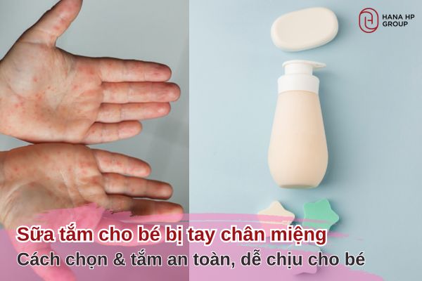 sữa tắm cho bé bị tay chân miệng