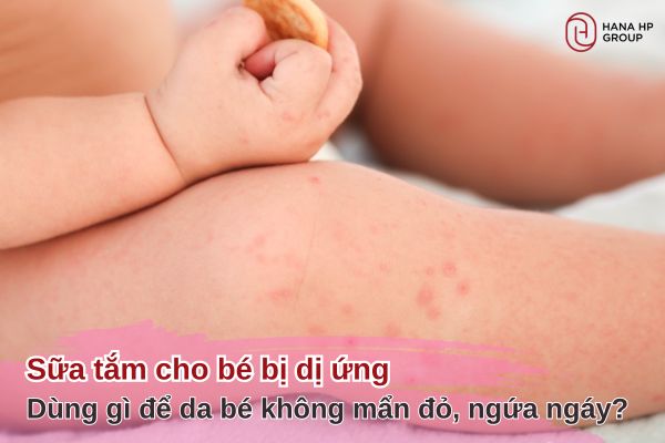 sữa tắm cho bé bị dị ứng