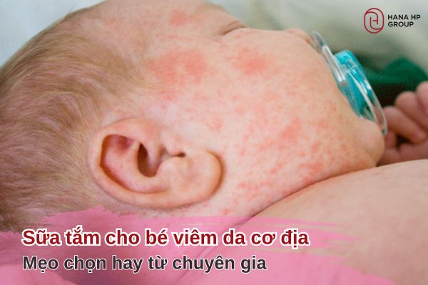 sữa tắm cho bé viêm da cơ địa