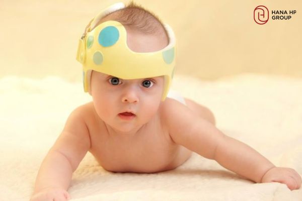 đầu trẻ sơ sinh bị dài