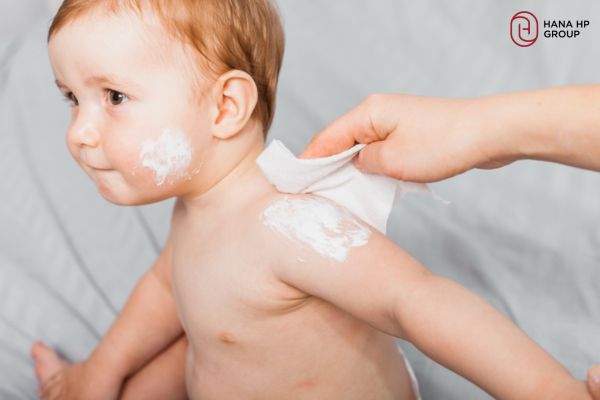 da đầu trẻ sơ sinh bị khô