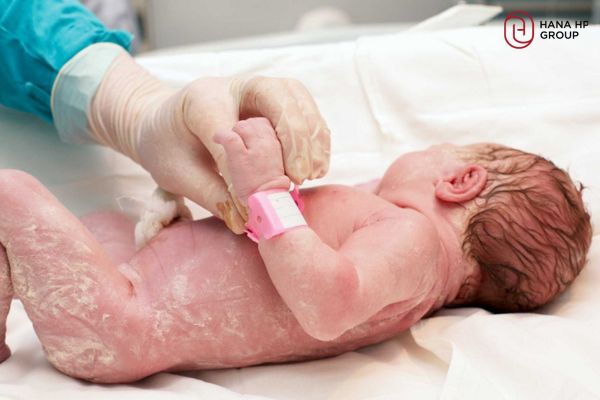 chất gây trên da trẻ sơ sinh