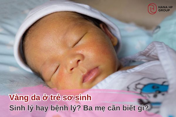vàng da trẻ sơ sinh