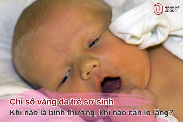 chỉ số vàng da trẻ sơ sinh