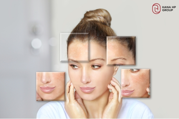 kem dưỡng ẩm cho da hỗn hợp