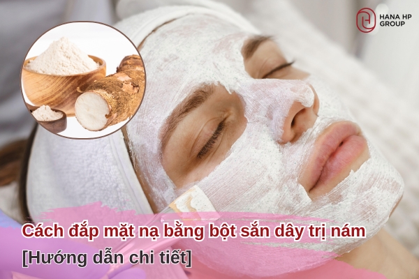 cách đắp mặt nạ bằng bột sắn dây trị nám