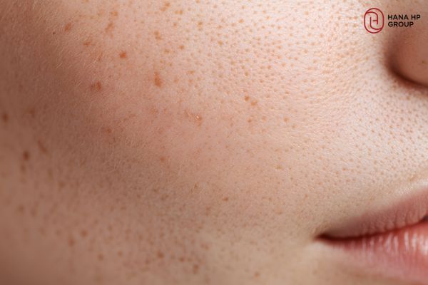 mặt nạ trứng gà mật ong