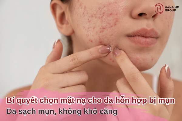 mặt nạ cho da hỗn hợp bị mụn
