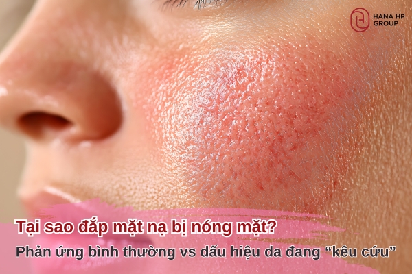 tại sao đắp mặt nạ bị nóng mặt