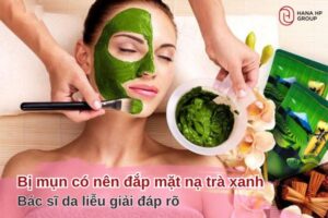 Bị mụn có nên đắp mặt nạ trà xanh không? Bác sĩ da liễu giải đáp rõ