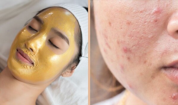 Da nhờn đắp mặt nạ gì? Top 11 loại mặt nạ làm sạch sâu hiệu quả nhất 3 da nhờn đắp mặt nạ gì