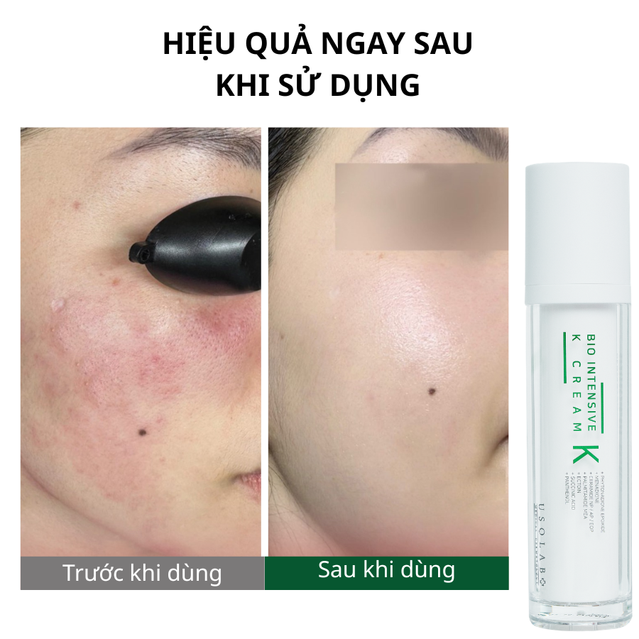 Kem dưỡng giảm đỏ, làm dịu tức thì Vitamin K Cream Usolab 2 Bio Intensive K Cream
