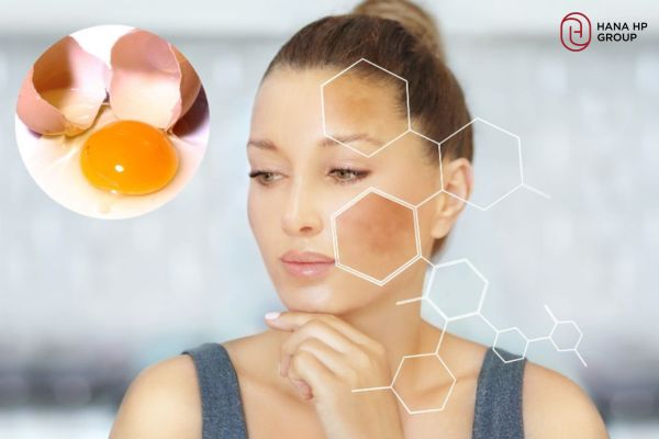 Phục hồi và nuôi dưỡng da, Làm sáng da và mờ thâm nám