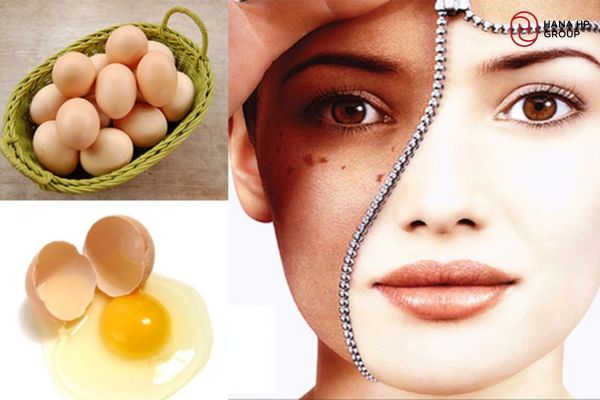 Lưu ý khi dùng mặt nạ trứng gà trị nám