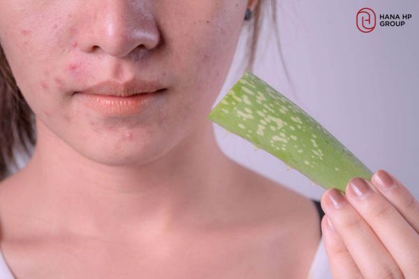 Lưu ý khi sử dụng mặt nạ nha đam