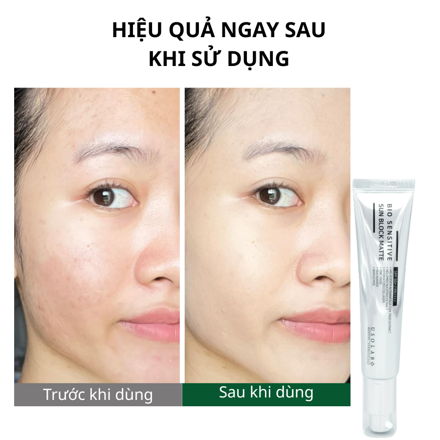 Kem chống nắng cho da dầu mụn Bio Sensitive Sun Block Matte 1 BIO SENSITIVE SUN BLOCK MATTE