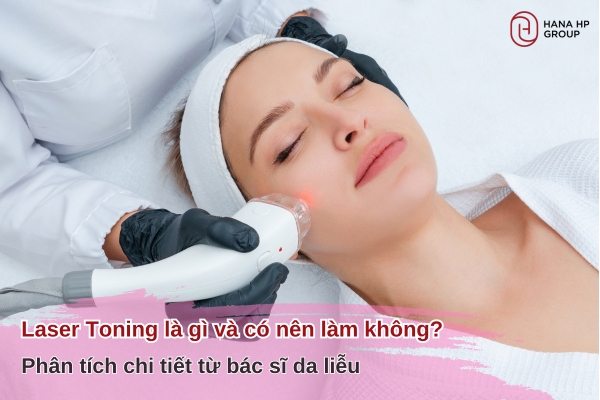 Laser Toning là gì