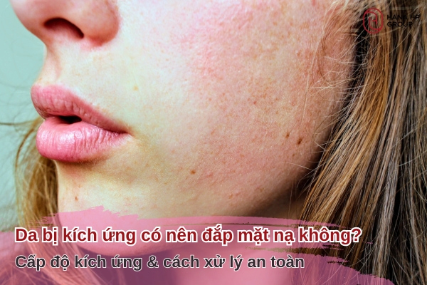 Da bị kích ứng có nên đắp mặt nạ không