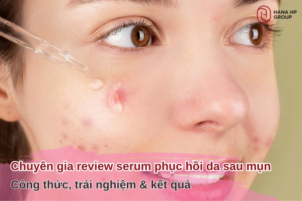 review serum phục hồi da sau mụn