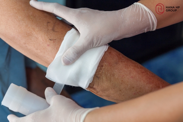 Hydrogel được dùng trong làm băng gạc hỗ trợ hồi phục vết thương