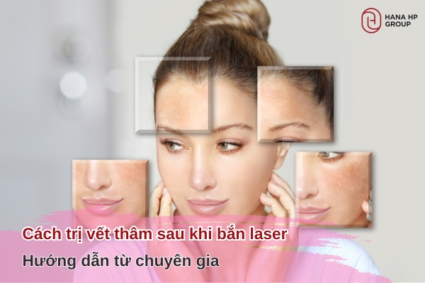 cách trị vết thâm sau khi bắn laser