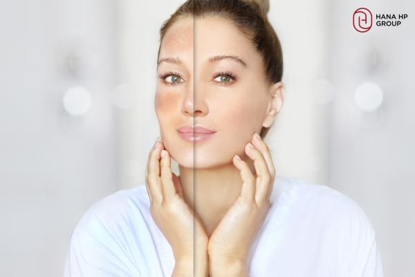 Làm sáng da nhờ các hoạt chất như Niacinamide, Vitamin C, Axit Kojic,... Làm sáng da nhờ các hoạt chất như Niacinamide, Vitamin C, Axit Kojic,...