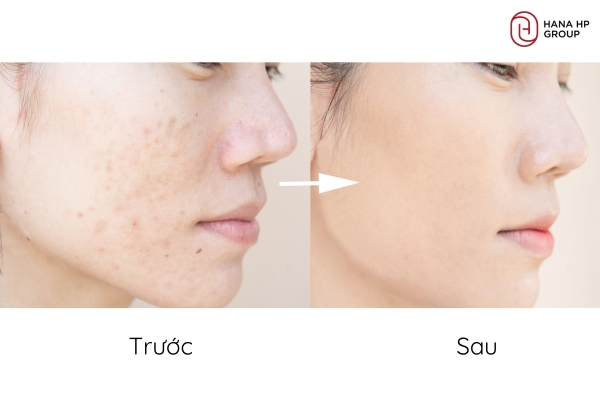 Cập nhật tình trạng da chi tiết trong quá trình trước, trong và sau khi dùng sản phẩm Cập nhật tình trạng da chi tiết trong quá trình trước, trong và sau khi dùng sản phẩm