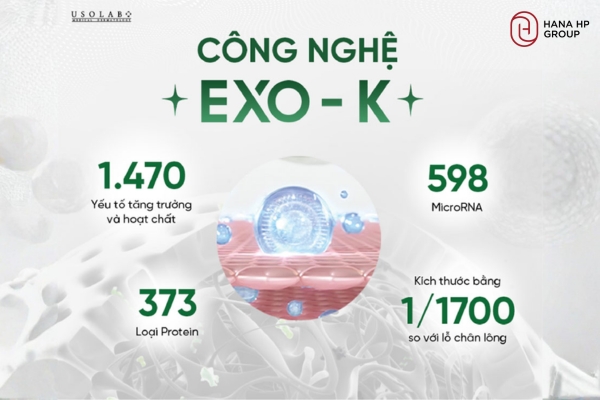 Công nghệ Exo-K độc quyền của thương hiệu Usolab