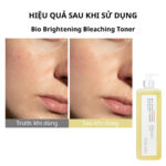nước hoa hồng Bio Brightening Bleaching Toner 1000ml