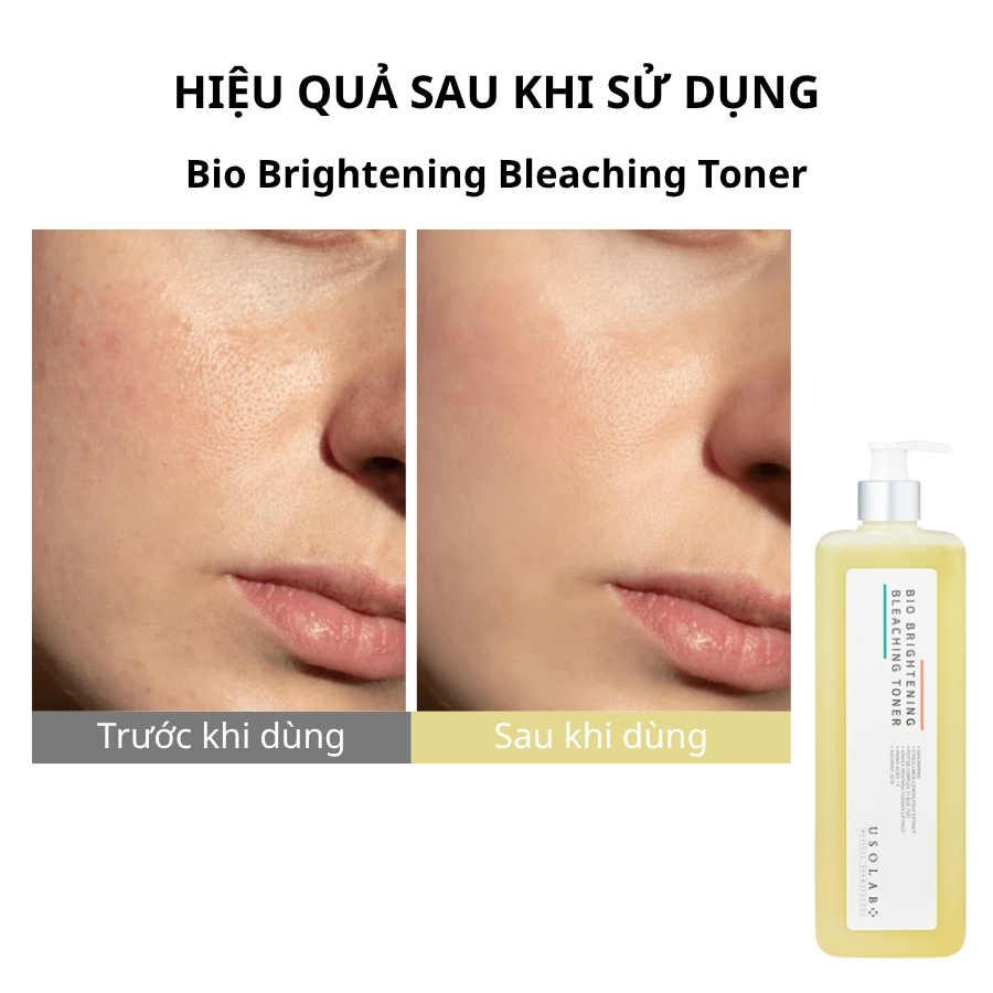 Nước hoa hồng trắng da, mờ nám Bio Brightening Bleaching Toner 1000ml (Salon Size) 1 nước hoa hồng Bio Brightening Bleaching Toner 1000ml