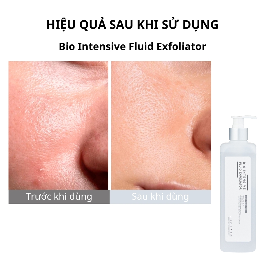 Tẩy da chết chuyên sâu BHA/AHA Bio Intensive Fluid Exfoliator 500ml (Salon Size) 1 BHA/AHA Bio Intensive Fluid Exfoliator 500ml