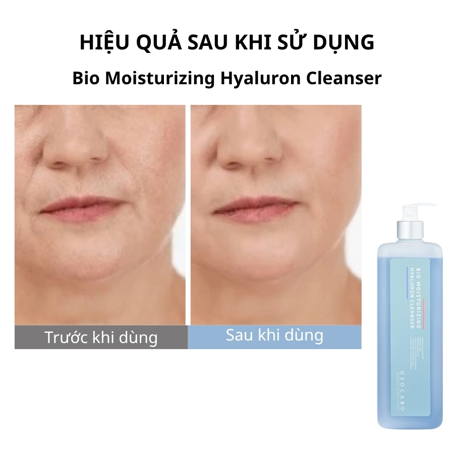 Sữa rửa mặt Bio Moisturizing Hyaluron Cleanser 1000ml