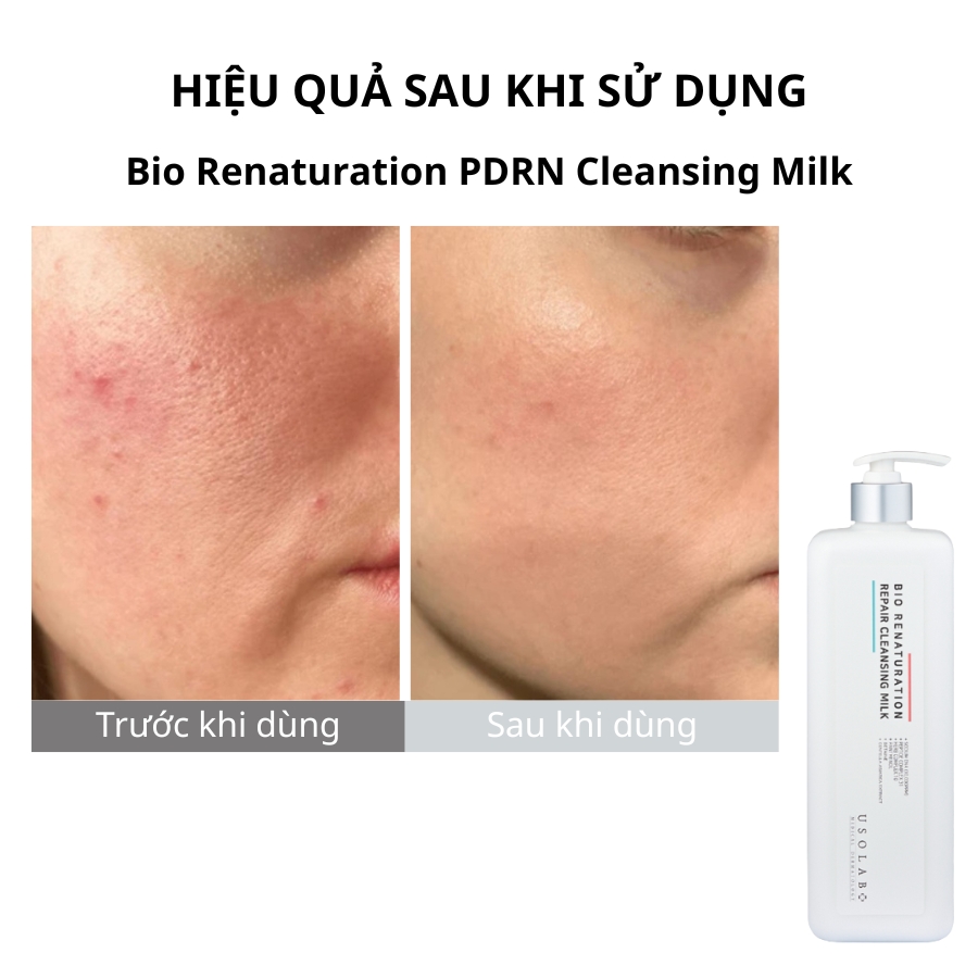 Bio Renaturation PDRN Cleansing Milk 1000ml