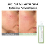 Sữa rửa mặt Bio Sensitive Purifying Cleanser 1000ml