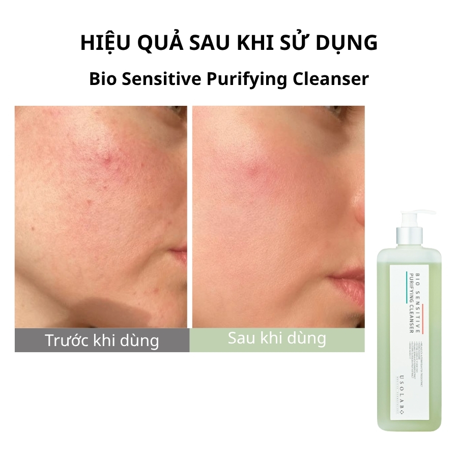 Sữa rửa mặt Bio Sensitive Purifying Cleanser 1000ml