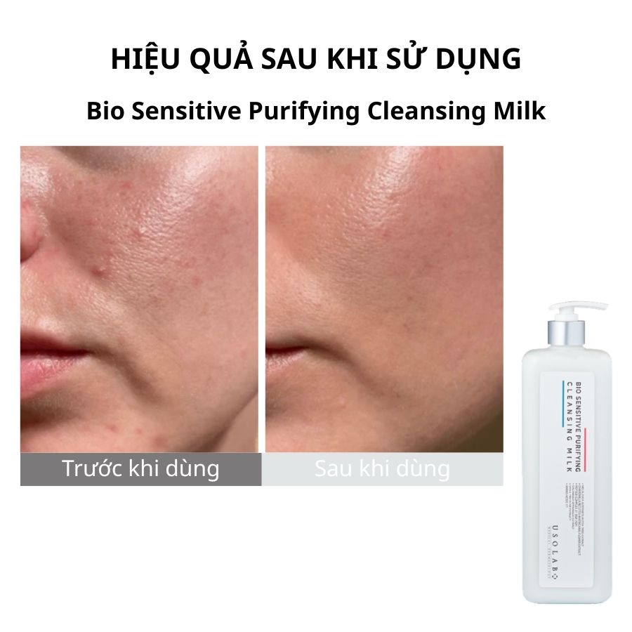 Tẩy trang dành cho da dầu mụn Bio Sensitive Purifying Cleansing Milk 1000ml (Salon size) 1 Usolab Bio Sensitive Purifying Cleansing Milk 1000ml