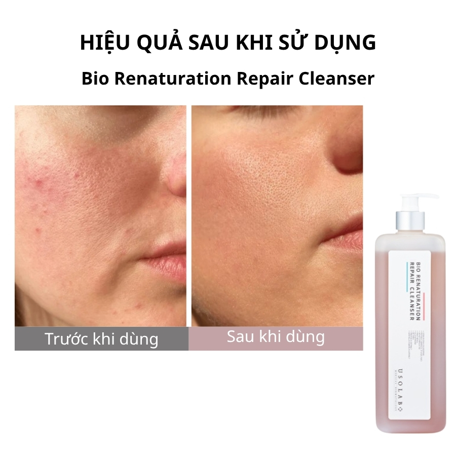 Sữa rửa mặt Bio Renaturation Repair Cleanser 1000ml